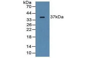 Figure. (FCN1 antibody  (AA 25-279))