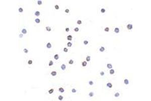 Immunocytochemistry of TLR6 in Jurkat cells with this product at 2 μg/ml. (TLR6 antibody  (Center))