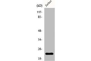 Western Blot analysis of Jurkat cells using D54 Polyclonal Antibody (TPD52L2 antibody  (C-Term))