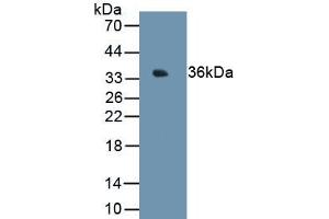 Detection of Recombinant MT1E, Human using Monoclonal Antibody to Metallothionein 1E (MT1E) (MT1E antibody  (AA 1-61))