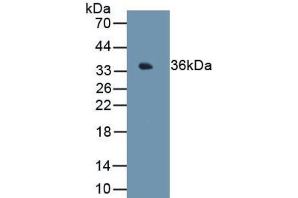 MT1E 抗体  (AA 1-61)