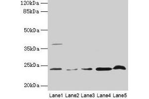 Western blot All lanes: CRYBA1 antibody at 6 μg/mL Lane 1: Human placenta tissue Lane 2: U251 whole cell lysate Lane 3: U937 whole cell lysate Lane 4: Mouse stomach tissue Lane 5: Mouse liver tissue Secondary Goat polyclonal to rabbit IgG at 1/10000 dilution Predicted band size: 26, 24 kDa Observed band size: 24 kDa (CRYBA1 antibody  (AA 1-215))