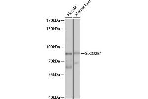 Western blot analysis of extracts of various cell lines, using SLCO2B1 antibody (ABIN6130909, ABIN6148066, ABIN6148067 and ABIN6214197) at 1:1000 dilution. (SLCO2B1 antibody  (AA 130-210))