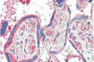 ABIN570663 (5µg/ml) staining of paraffin embedded Human Plcenta. (TXK antibody  (C-Term))