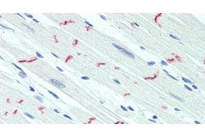 Desmoglein 2 antibody