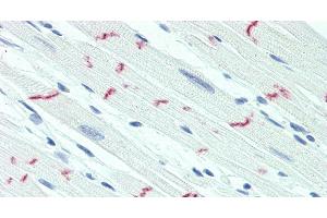 Immunohistochemistry of paraffin-embedded Heart tissue using DSG2 Polyclonal Antibody at dilution of 1:60.