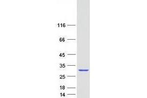 Validation with Western Blot
