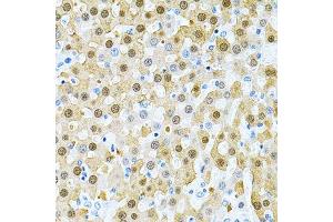 Immunohistochemistry of paraffin-embedded rat liver using PIBF1 Antibody. (PIBF1 antibody)