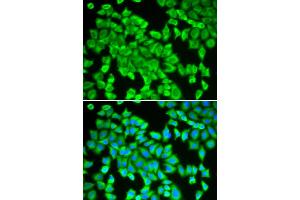 Immunofluorescence analysis of HeLa cells using STIP1 antibody (ABIN5970561). (STIP1 antibody)