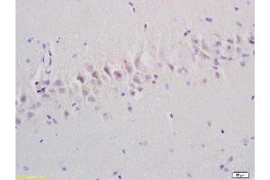 Formalin-fixed and paraffin embedded rat brain tissue labeled with Anti-Emp1/MUC1 Polyclonal Antibody, Unconjugated at 1:200, followed by conjugation to the secondary antibody and DAB staining (EMP1 antibody  (AA 101-160))