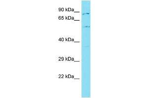 Host: Rabbit Target Name: GLT25D2 Sample Type: MCF7 Whole Cell lysates Antibody Dilution: 1. (GLT25D2 antibody  (C-Term))