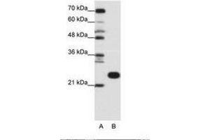 Image no. 1 for anti-Ribosomal Protein L13 (RPL13) (C-Term) antibody (ABIN6736166) (RPL13 antibody  (C-Term))