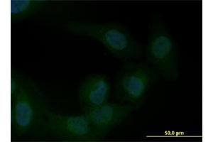 Immunofluorescence of monoclonal antibody to ZEB1 on U-2 OS cell. (ZEB1 antibody  (AA 801-900))