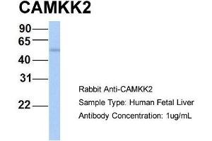 Host: Rabbit  Target Name: CAMKK2  Sample Tissue: Human Fetal Liver  Antibody Dilution: 1. (CAMKK2 antibody  (N-Term))
