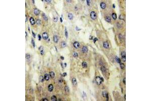 Immunohistochemical analysis of FATP5 staining in human liver formalin fixed paraffin embedded tissue section. (SLC27A5 antibody  (Center))