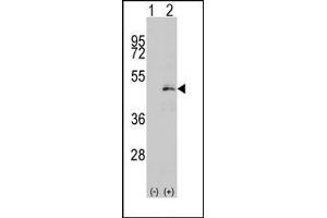 Image no. 1 for anti-Mitogen-Activated Protein Kinase Kinase 1 (MAP2K1) (Ser216) antibody (ABIN360367) (MEK1 antibody  (Ser216))