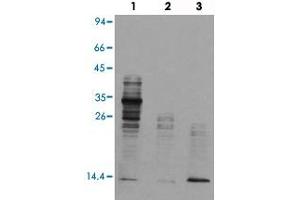 Western blot analysis of Lane 1: mouse brain tissue lysates, Lane 2: Hela cell lysates, Lane 3: TSA treated Hela cell lysates reacted with Acetyl lysine monoclonal antibody  at 1:1000-1:2000 dilution. (Acetylated Lysine antibody  (acetylated))
