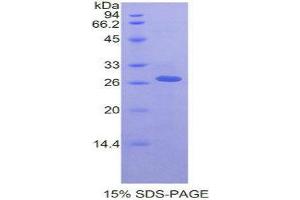 SDS-PAGE (SDS) image for Receptor-Interacting serine-threonine Kinase 3 (RIPK3) (AA 50-272) protein (His tag) (ABIN2126634)