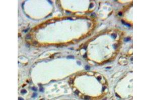 Used in DAB staining on fromalin fixed paraffin-embedded Kidney tissue (CA12 antibody  (AA 25-302))