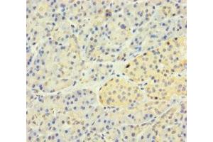 Immunohistochemistry of paraffin-embedded human pancreatic tissue using ABIN7170187 at dilution of 1:100 (SLC25A35 antibody  (AA 120-168))