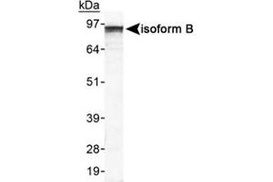Western blot analysis of EPB41L3 in HeLa whole cell lysate using EPB41L3 polyclonal antibody .