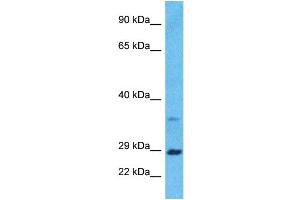 Host:  Rabbit  Target Name:  BDNF  Sample Type:  ACHN Whole Cell lysates  Antibody Dilution:  1ug/ml (BDNF antibody  (Middle Region))