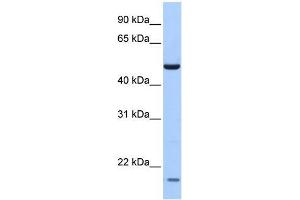 Human Lung; WB Suggested Anti-ZNF764 Antibody Titration: 0.