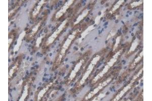 DAB staining on IHC-P; Samples: Mouse Kidney Tissue (Ninein antibody  (AA 1-153))