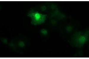 Image no. 2 for anti-Catenin (Cadherin-Associated Protein), beta 1, 88kDa (CTNNB1) antibody (ABIN1496898) (CTNNB1 antibody)