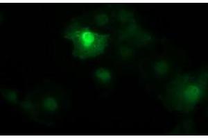 Image no. 2 for anti-Catenin (Cadherin-Associated Protein), beta 1, 88kDa (CTNNB1) antibody (ABIN1496898)