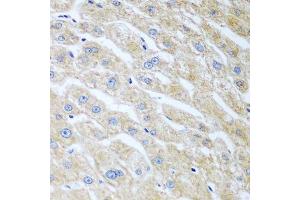 Immunohistochemistry of paraffin-embedded human liver using UCHL3 antibody. (UCHL3 antibody  (AA 1-220))