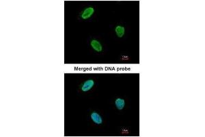 ICC/IF Image Immunofluorescence analysis of paraformaldehyde-fixed HeLa, using Rad9 , antibody at 1:100 dilution. (RAD9A antibody  (Center))