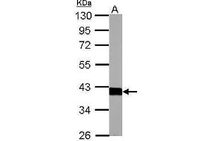 WB Image Aldolase B antibody detects ALDOB protein by Western blot analysis.