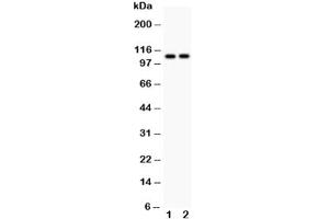 Western blot testing of ATP2A1 antibody and Lane 1:  rat skeletal muscle (ATP2A1/SERCA1 antibody  (N-Term))