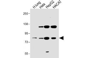 All lanes : Anti-SLC6A14 Antibody (C-term) at 1:1000 dilution Lane 1: Human lung lysate Lane 2: Hela whole cell lysate Lane 3: HepG2 whole cell lysate Lane 4: HACAT whole cell lysate Lysates/proteins at 20 μg per lane. (Slc6a14 antibody  (C-Term))