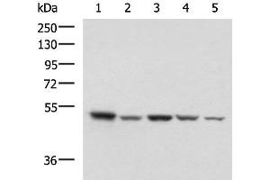 Western blot analysis of HepG2 NIH/3T3 C2CL2 Raji and Jurkat cell lysates using ENO3 Polyclonal Antibody at dilution of 1:1000 (ENO3 antibody)