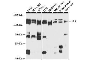 Western blot analysis of extracts of various cell lines, using FER antibody  at 1:1000 dilution. (FER antibody  (AA 200-450))