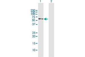 Western Blot analysis of STK33 expression in transfected 293T cell line by STK33 MaxPab polyclonal antibody. (STK33 antibody  (AA 1-514))