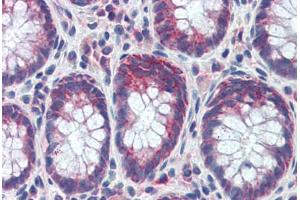 Human Colon (formalin-fixed, paraffin-embedded) stained with GATA6 antibody ABIN462170 followed by biotinylated goat anti-rabbit IgG secondary antibody ABIN481713, alkaline phosphatase-streptavidin and chromogen. (GATA6 antibody  (C-Term))