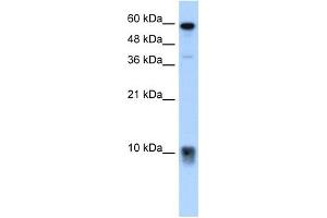 S100A3 antibody used at 5 ug/ml to detect target protein.
