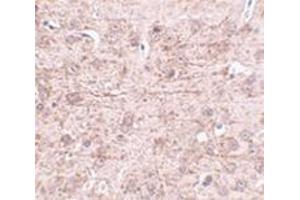 Immunohistochemistry of ZBTB1 in mouse brain tissue with this product at 2. (ZBTB1 antibody  (Center))
