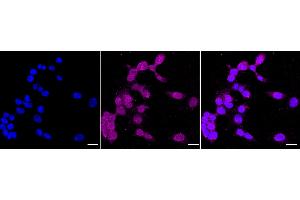 anti-Myc Proto-Oncogene protein (MYC) (pThr58) antibody