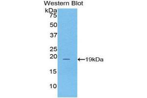 Western Blotting (WB) image for anti-Adrenoceptor alpha 1A (ADRA1A) (AA 330-466) antibody (ABIN1857926) (alpha 1 Adrenergic Receptor antibody  (AA 330-466))