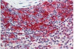 Human Spleen: Formalin-Fixed, Paraffin-Embedded (FFPE)