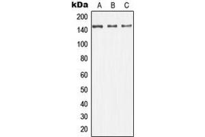 Western blot analysis of ASK1 expression in HeLa (A), SP2/0 (B), H9C2 (C) whole cell lysates. (ASK1 antibody  (N-Term))