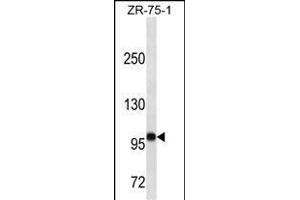 FUT4 Antibody (ABIN1539891 and ABIN2843850) western blot analysis in ZR-75-1 cell line lysates (35 μg/lane).