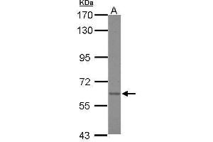 WB Image Sample (30 ug of whole cell lysate) A: A431 7. (Asparagine Synthetase antibody)