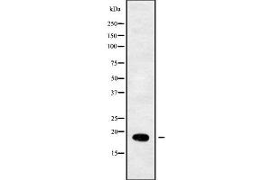 Western blot analysis of RPL29 using COLO205 whole cell lysates (RPL29 antibody  (Internal Region))