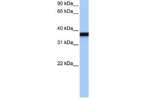 WB Suggested Anti-GSG1 Antibody Titration: 0.