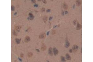 IHC-P analysis of Rat Tissue, with DAB staining. (NPPC antibody  (AA 31-126))